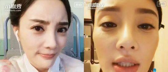 嘴角下垂明星,揭秘嘴角下垂明星的美丽故事